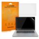 Σετ 2 μεμβρανών προστασίας κάμερας Kwmobile για Lenovo Yoga 530 (14"), Διαφανές, Πλαστικό, 51149.2